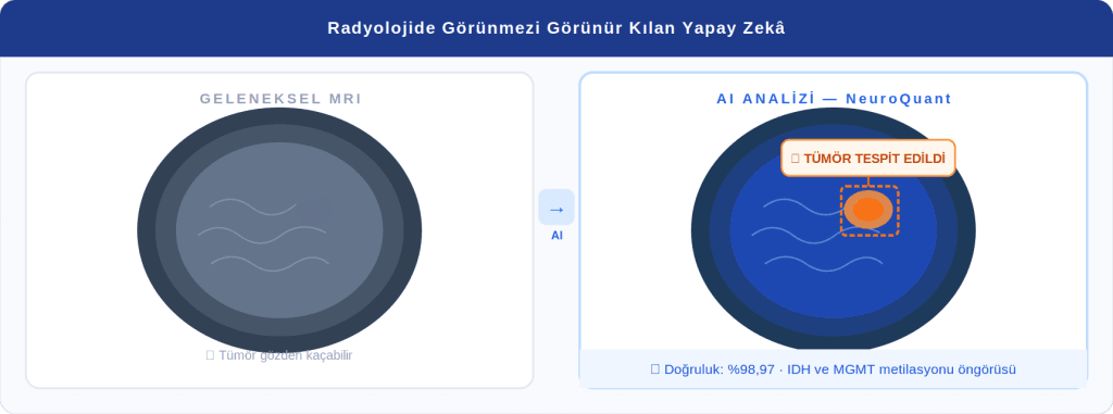 02 beyin tumoru mri ai 1